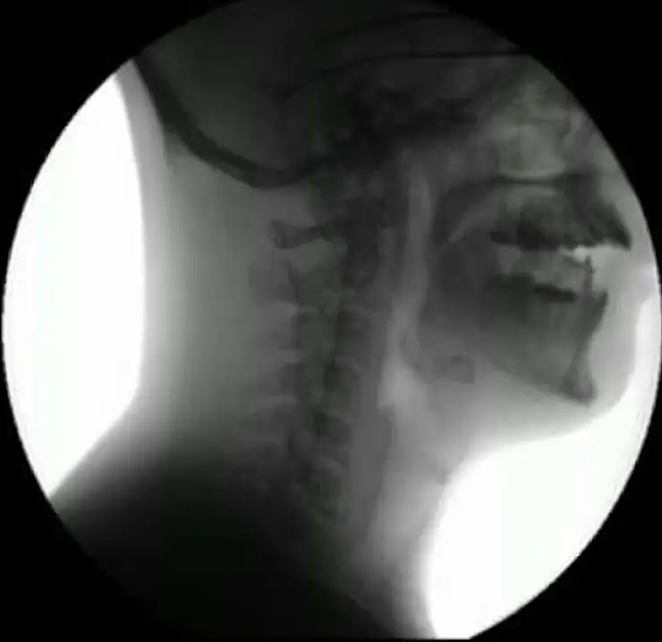 still image of a digital motion xray