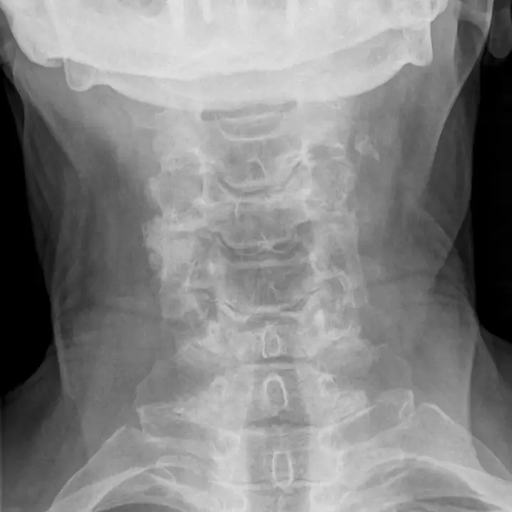 Digital Motion Xray Samples